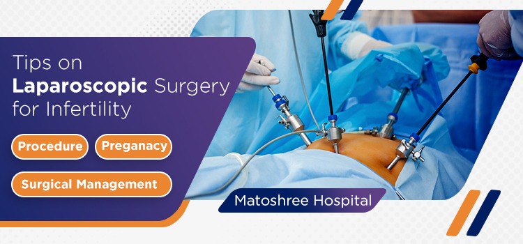 Tips on laparoscopiv surgery